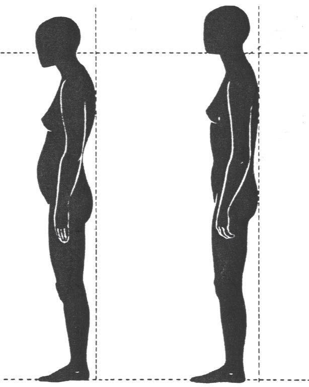Alexander Technique: Principles for improving posture and relieving ...
