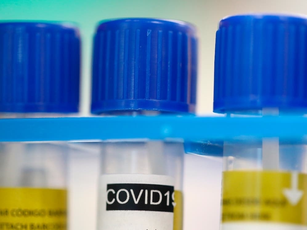 Neighboring Alameda County reported is first coronavirus-related death on Monday.