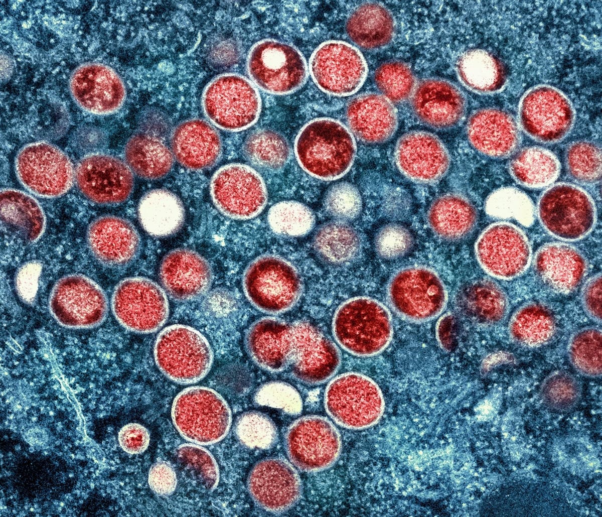This image provided by the National Institute of Allergy and Infectious Diseases (NIAID) shows a colorized transmission electron micrograph of monkeypox particles (red) found within an infected cell (blue).