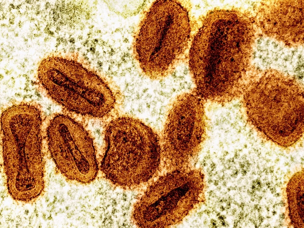 FILE - This colorized electron microscope image provided by the National Institute of Allergy and Infectious Diseases in 2024 shows Mpox virus particles, orange, found within infected cells, green.