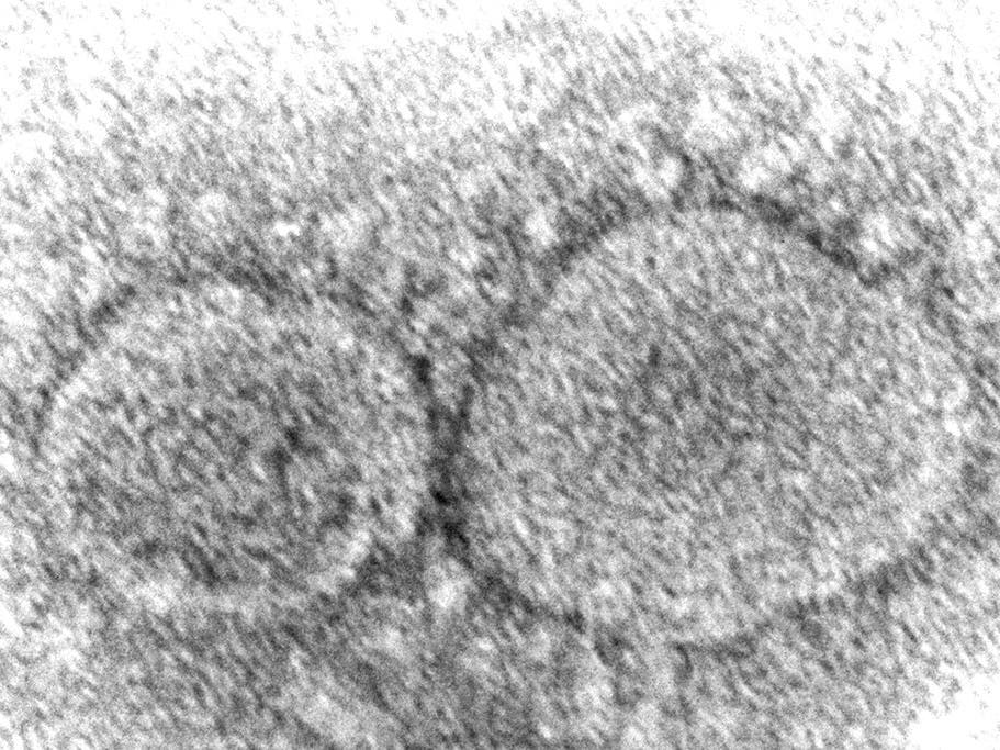This 2020 electron microscope image made available by the Centers for Disease Control and Prevention shows SARS-CoV-2 virus particles which cause COVID-19. 