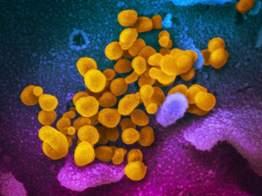 State and county health agencies confirmed 18 cases of COVID-19 have been diagnosed in Washington, including 14 in King County and four in Snohomish County.