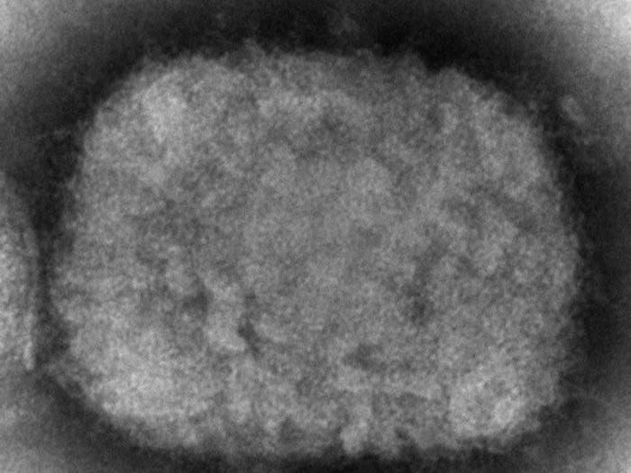 This 2003 electron microscope image made available by the Centers for Disease Control and Prevention shows a monkeypox virion, obtained from a sample associated with the 2003 prairie dog outbreak.