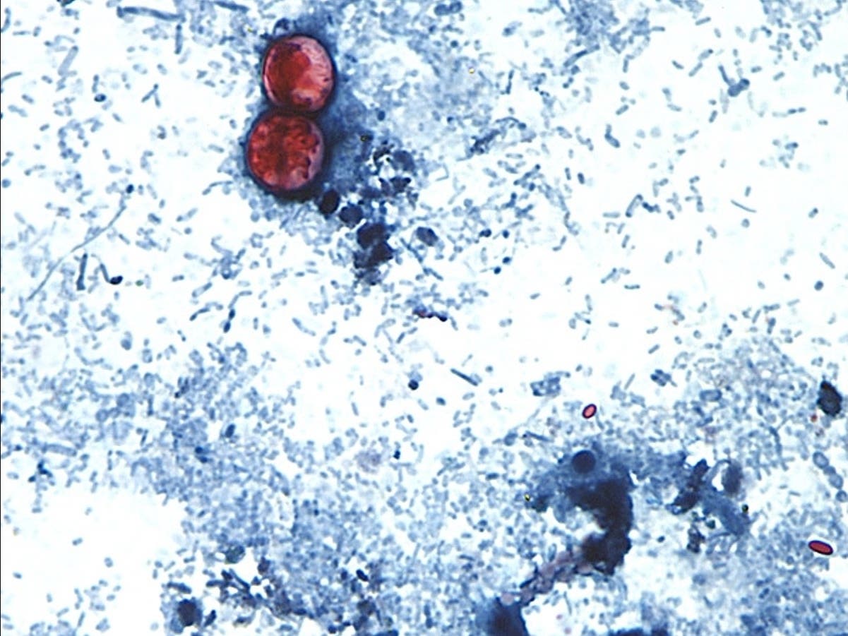 Health officials have not identified a specific produce item, grower, supplier, restaurant, grocery chain or Illinois location tied to cyclosporiasis, the diarrhea-causing parasite.