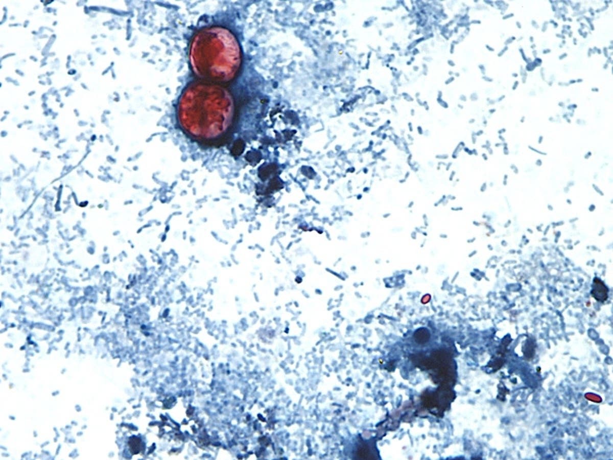 Cyclospora cayetanensis is a tiny heat-loving parasite that infects the bowels and spreads through feces.