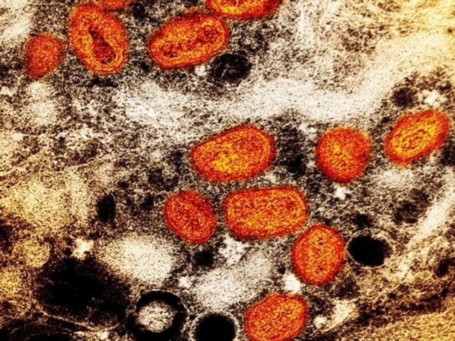 This iamge provided by the National Institute of Allergy and Infectious Diseases (NIAID) shows a colorized transmission electron micrograph of monkeypox particles (orange) found within an infected cell (brown), cultured in the laboratory.