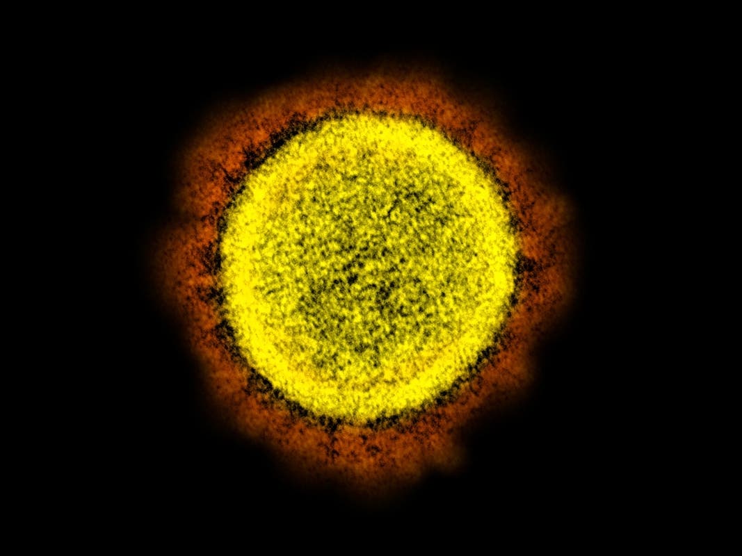 This electron microscope image made available by the National Institute of Allergy and Infectious Diseases shows a Novel Coronavirus SARS-CoV-2 particle isolated from a patient, in a laboratory in Fort Detrick, Md.