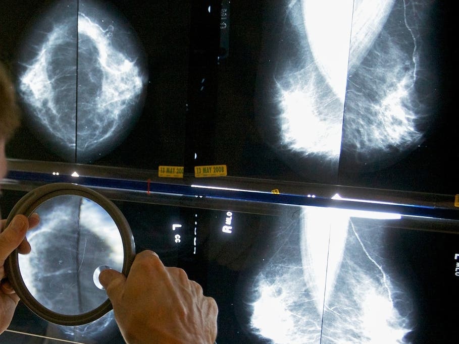Mammograms can detect breast cancer before a lump can be felt or symptoms appear, when the disease is generally easier to treat. Regular mammograms can lower the risk of dying from breast cancer.
