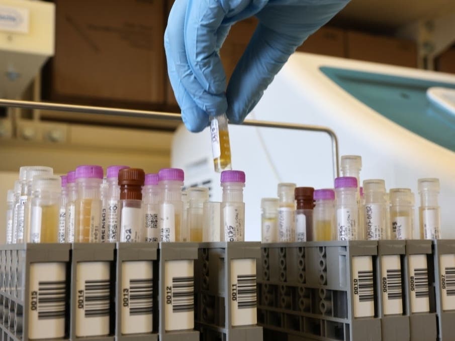 Researchers at the UW Medicine Retrovirology Lab at Harborview Medical Center work on samples from the Novavax phase 3 Covid-19 clinical vaccine trials on Feb. 12, 2021, in Seattle.