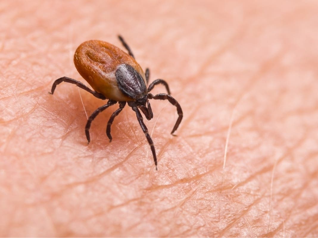 Princeton Urges Tick Bite Precautions As Alpha-gal Cases Continue In New Jersey