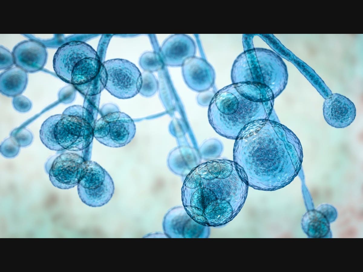 Potentially Deadly, Drug-Resistant Fungus Spreads In WI: What To Know