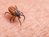 ER Visits For Tick Bites At Highest Level In A Decade: What To Know In VA