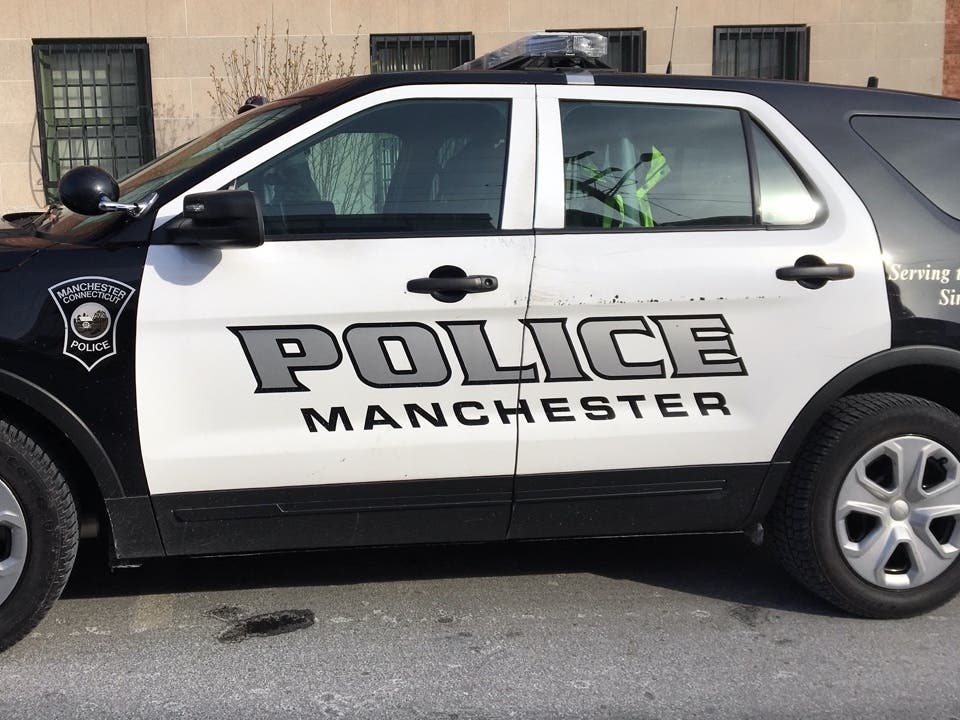 A teen pedestrian was hit by a car in Manchester Wednesday. 