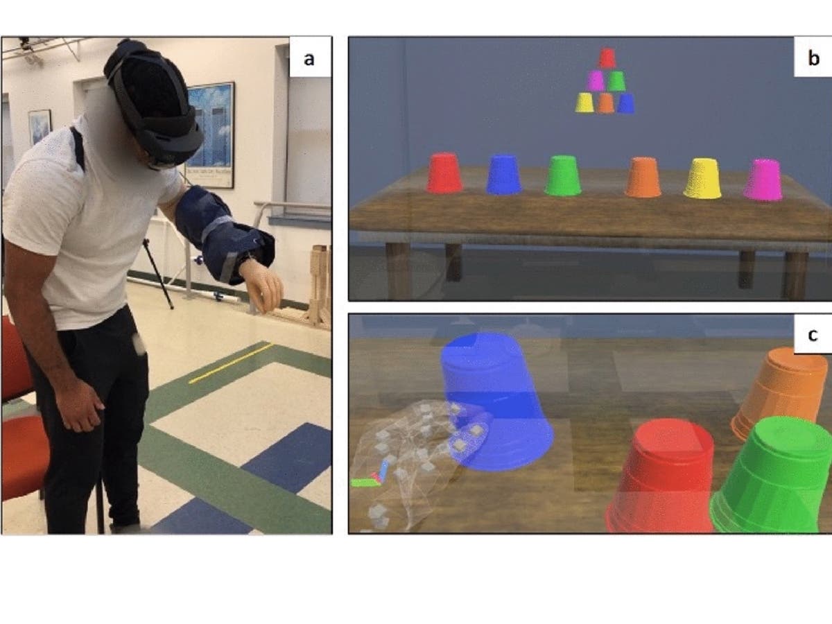 A participant in Susan D’Andrea’s study wears the bypass prosthesis and Microsoft HoloLens2 headset to play the augmented reality training game ARm-Strong.