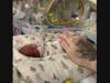 Nova Rae was born 12 weeks early.