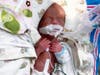 Nova Rae is a fighter, her parents said.