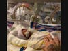 The community is rallying around a preemie with a GoFundMe page.