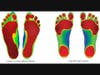 We can scan your feet with our 3D laser foot scanner to see the imbalances, show how it affects your spine and have custom fitted orthotics produced for you.