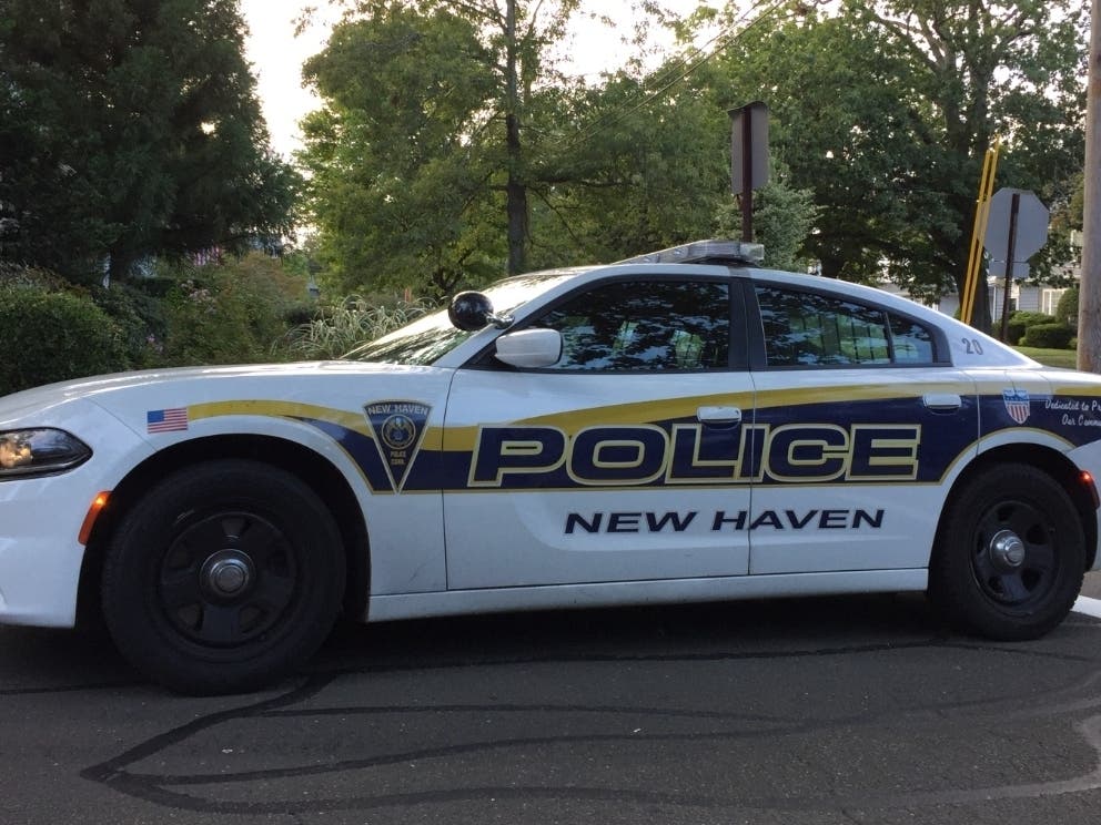 Police are investigating Whalley Avenue shooting. 