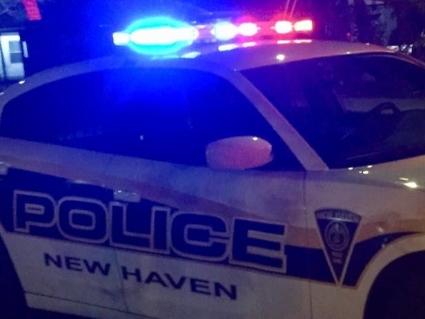 The 16-year-old boy who'd been shot was rushed to Yale New Haven Hospital, where he died from his injuries.