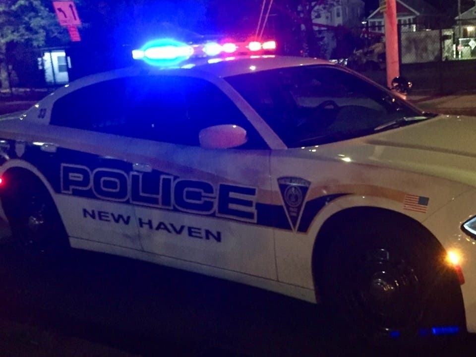 New Haven police detectives ask that  anyone with information related to the shooting call  203-946-6304 or via the department's anonymous tips line at 866-888-8477.