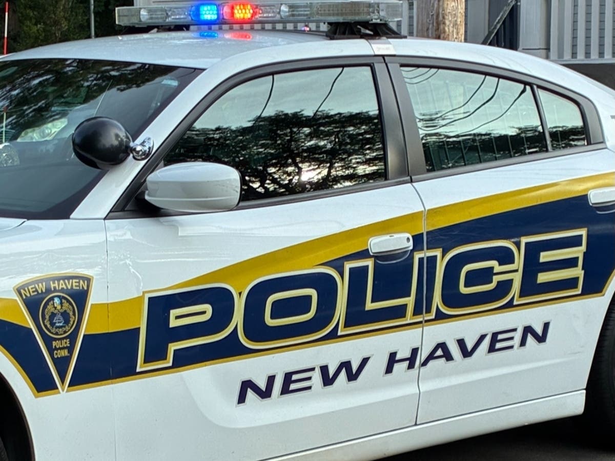Taken to Yale New Haven Hospital, the 21-year-old victim is listed in stable condition, police said.