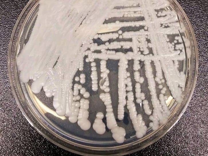 A strain of Candida auris cultured in a petri dish at a Centers for Disease Control and Prevention laboratory.