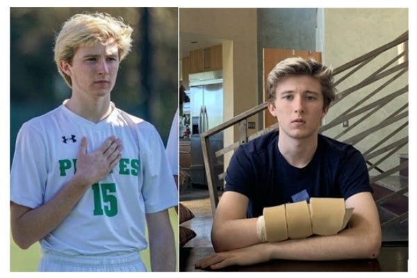 Luke O’Heidhin, a senior at Sir Francis Drake High School in San Anselmo, is recovering from spring break accident.