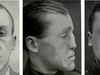 Plastic surgery helped wounded WWI soldiers heal and live a normal life off the battlefield. 