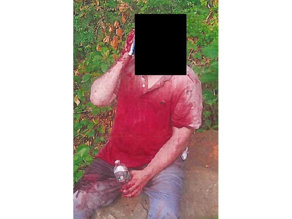 A victim was left bloodied after a robbery and assault on June 12, 2026. His polo shirt was light blue before the attack, prosecutors said.