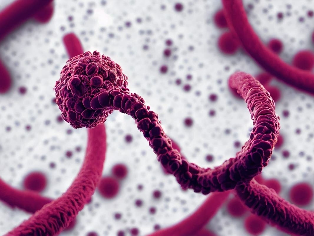 First U.S. Ebola Patient In Latest Strain Has Connections To Montgomery Co.