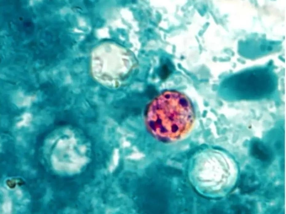 The ongoing cyclosporiasis outbreak has impacted Pennsylvania.