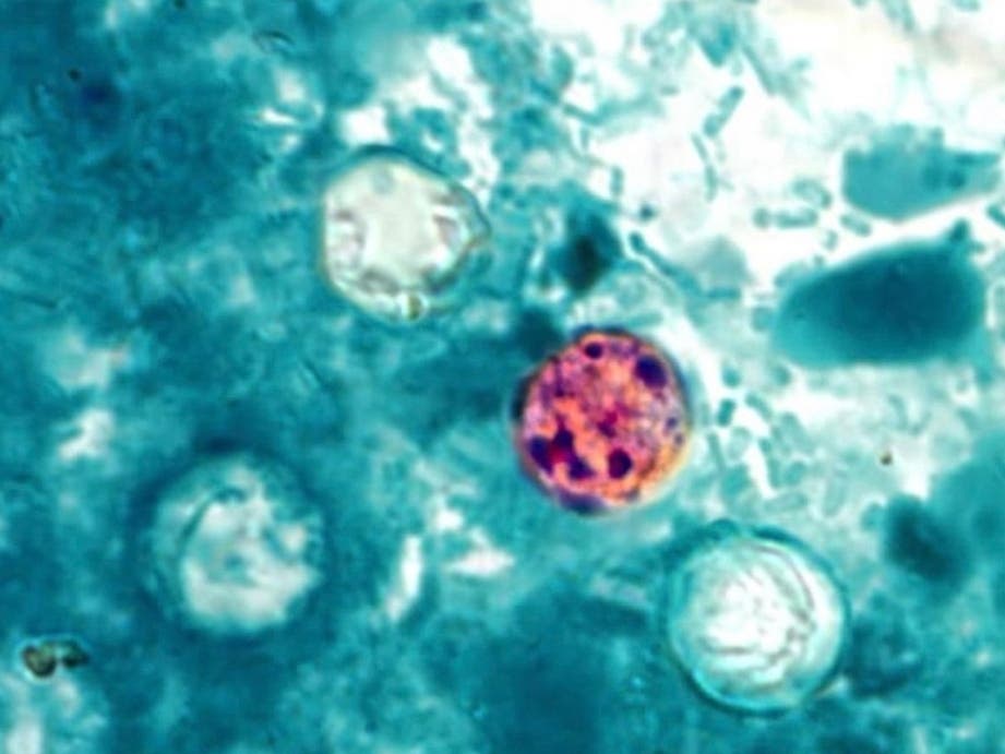Cases of the cyclosporiasis parasite have rapidly increased around the country over the past week, including in Pennsylvania.