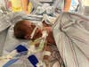Sully at four weeks in the NICU at Children's Hospital of Philadelphia.