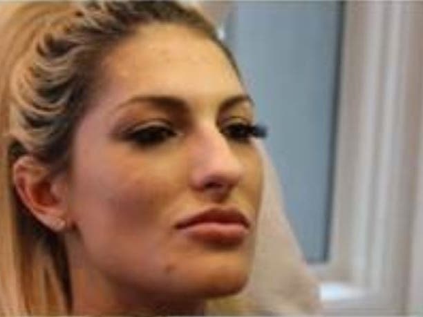 Police believe Lauren L. Klavano fled after receiving Botox treatments in Kirkland.