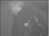 Westborough police released surveillance images of the intruders associated with a recent string of burglaries.