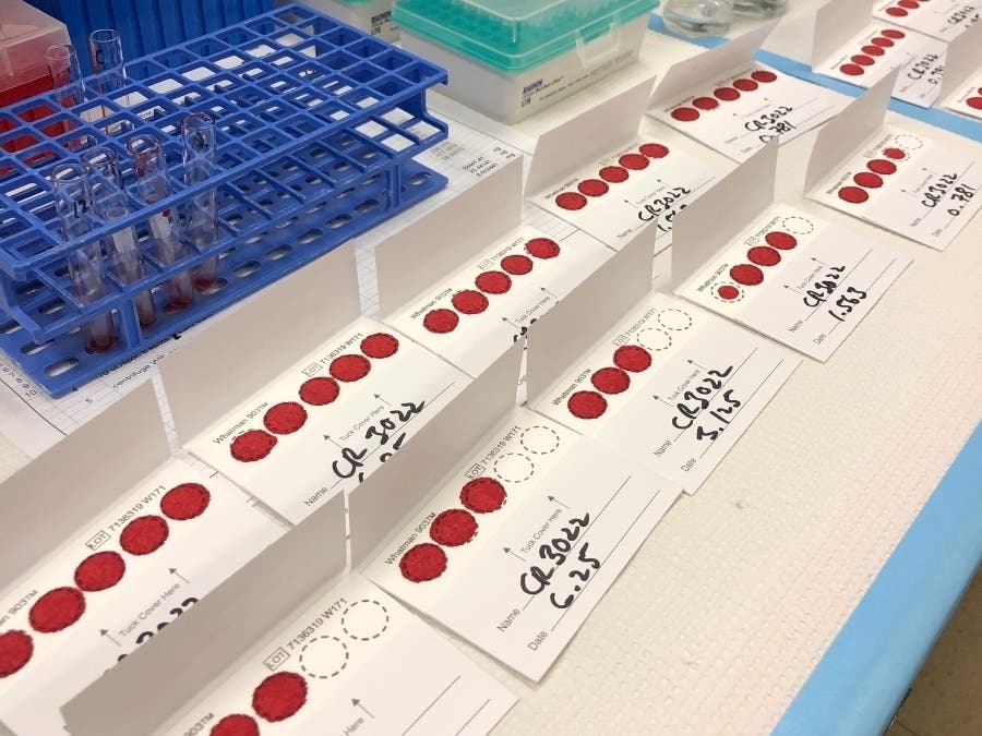 An antibody test that requires only a single drop of blood was developed in May by a team of scientists at Northwestern University.
