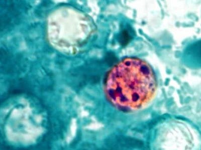 The cyclospora parasite
