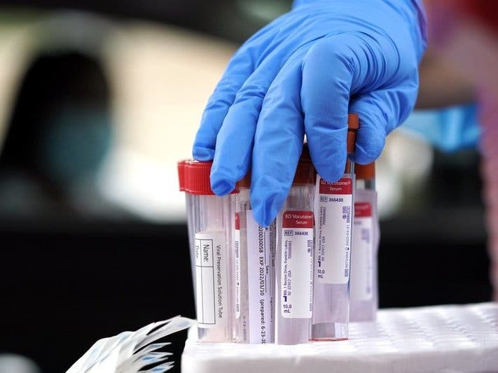 Healthcare professional Kenzie Anderson grabs a test tube for a sample at United Memorial Medical Center COVID-19 testing site in Houston. 