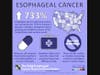 April is Esophageal Cancer Awareness Month. 