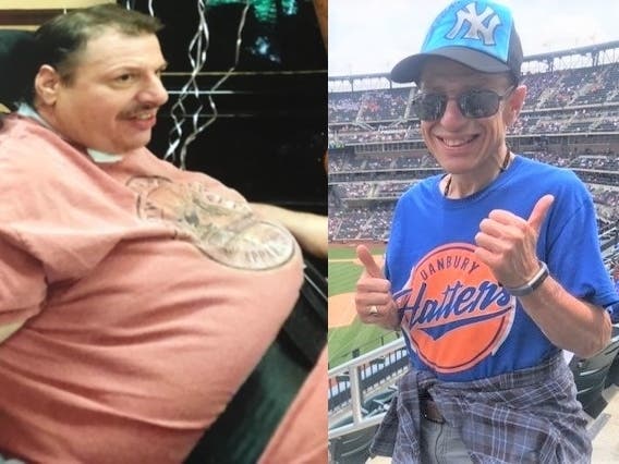 Before and after photos of Brian Miguel illustrate the transformative 106-pound weight loss guided by the team at one of Ability Beyond’s residential homes in Brookfield. 