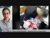 “'The Worst of What Humanity Is Capable Of' - Pediatrician Dr. Tanya Haj-Hassan on What She Saw in Gaza." www. democracynow.org/2024/3/28/gaza_msf. The girl in the photo died of her burns. Having tried to keep her alive, the exhausted medic collapses. 