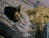 Zahra Assi, 7 years old, lost her mother and two brothers in an Israeli air strike in Lebanon on September 29, 2024. Her leg was severely injured. 