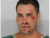 The victim tried to fight the people attacking him off, police said.