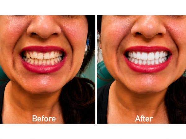 ProCare Family Dental - Morton Grove