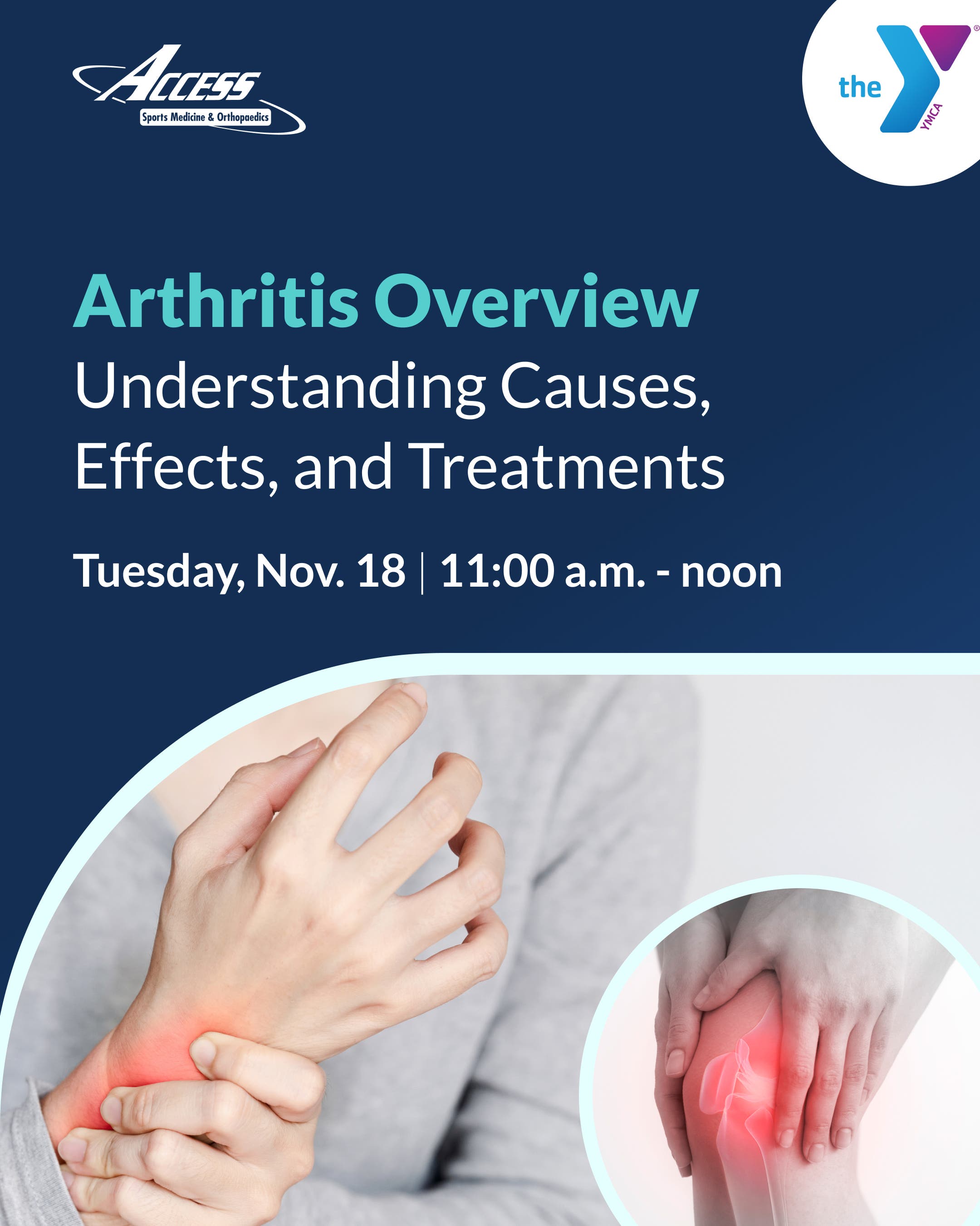 Arthritis Overview with Michael Smith, PA-C