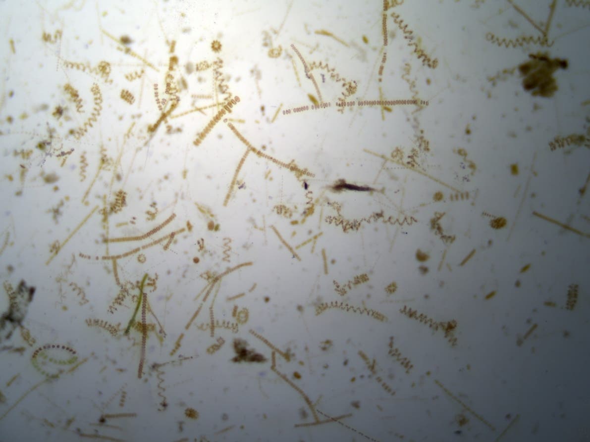 An image of a recent plankton bloom that has happened in the Hudson River Park.