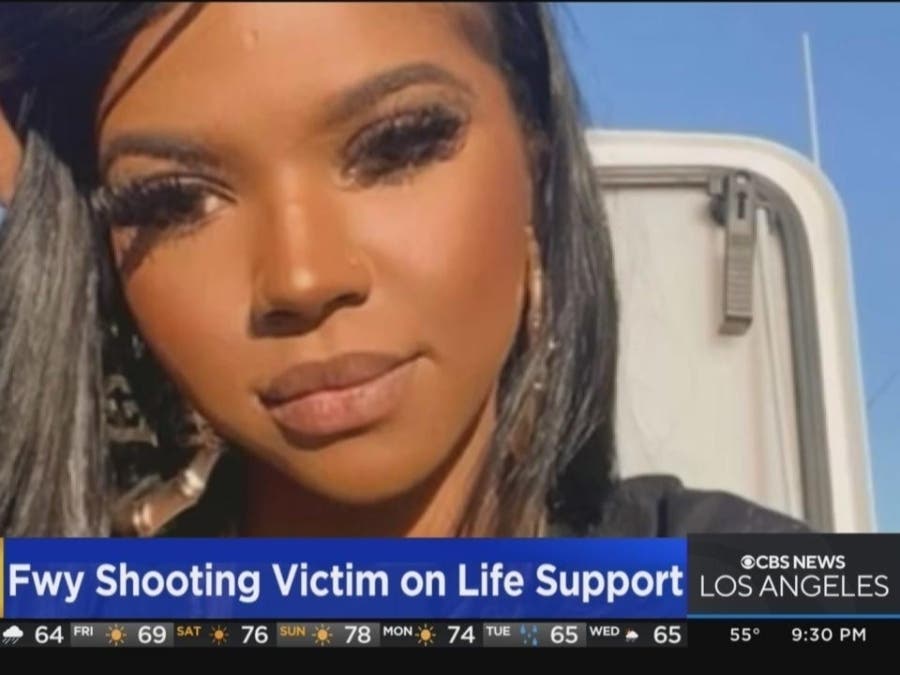 Father Of Woman Shot In Head On 101 Freeway Speaks Out As Daughter