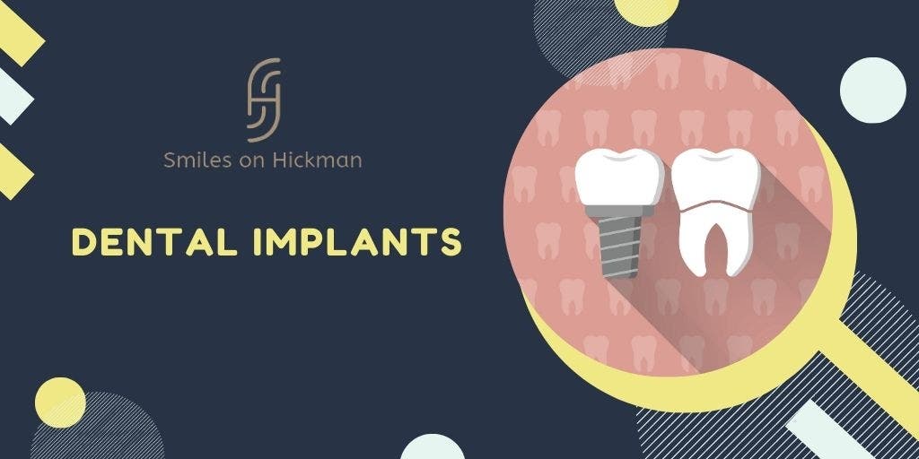 Dental Implants Des Moines, IA Patch