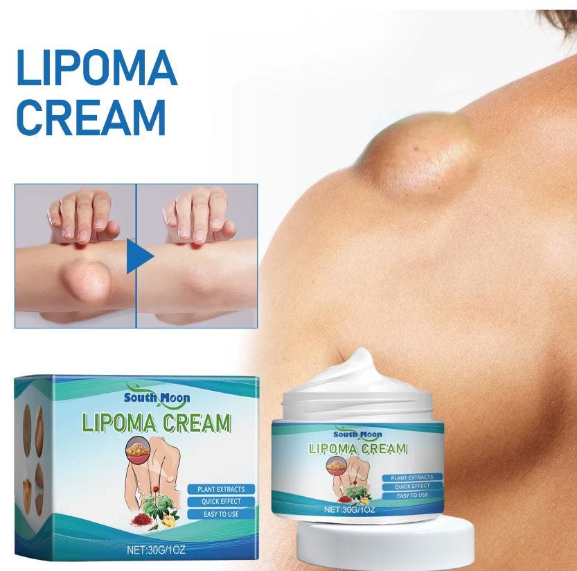 Natural Herbal Lipoma Removal Cream